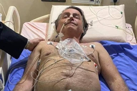 Cirurgia de Bolsonaro foi satisfatória e primeiras 48 horas são críticas, diz médico